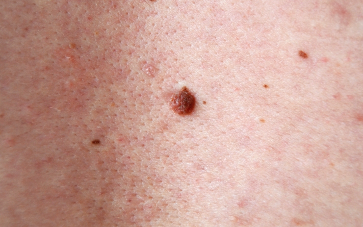 Ilustrační foto: e-chomutovsko znaminko po ořezu a úpravě