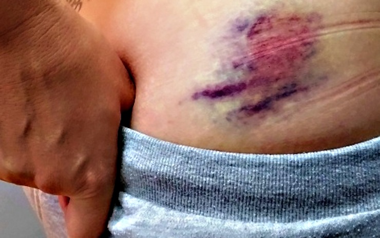 Ilustrační foto Ilustrační foto