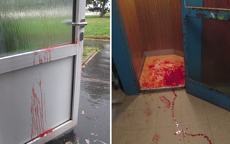 Zraněný muž značně krvácel. Během chvíle byl výtah plný krve. Foto: Měp Chomutov