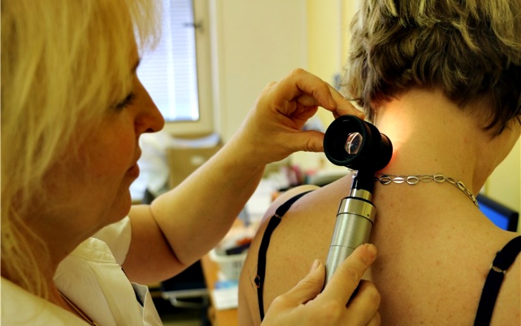 Evropský den melanomu v Chomutově: Znaménka si nechalo vyšetřit 134 lidí