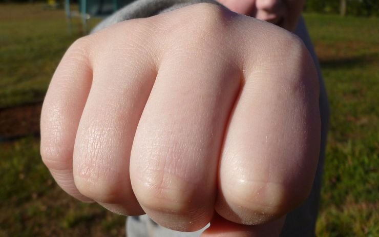 Napadení za bílého dne! Muž schytal na ulici několik ran a skončil s rozbitým telefonem