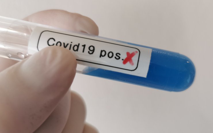 Koronavirus si v kraji vyžádal už tři životy. Pozitivních je 138 lidí