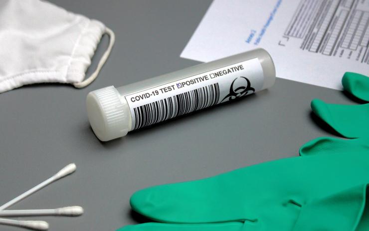 Hygienička zastrašuje? Policie odvede dítě na koronavirový test. Proti vůli rodičů