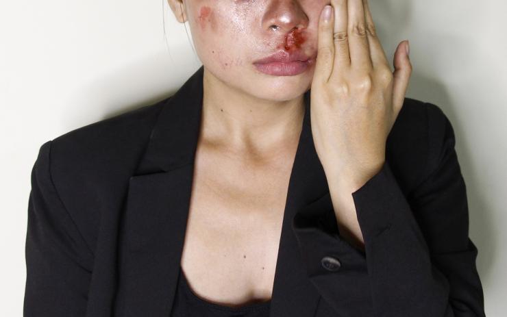 Muž (33) napadl na ulici v Nejdku ženu tak, že musela vyhledat lékaře