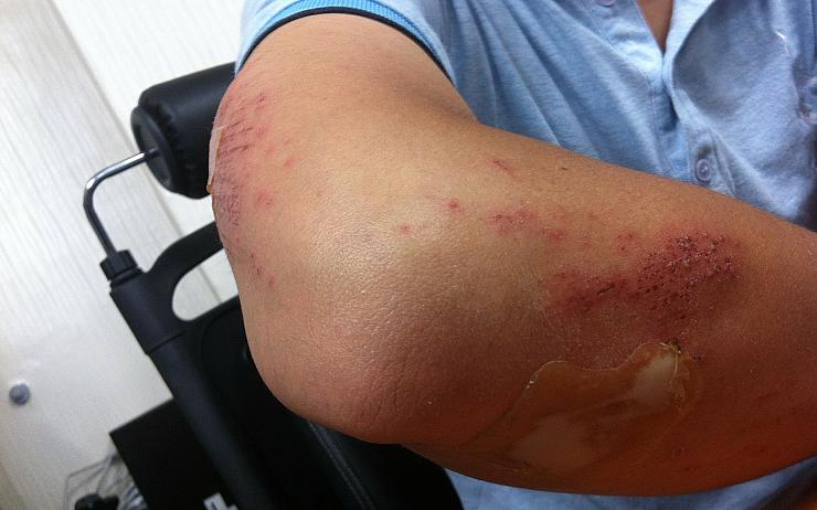 Muži při čekání na jídlo v restauraci ruply nervy, pěstí napadl číšníka