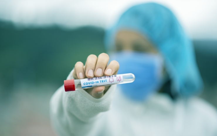 Mondi Štětí nabízí testování na koronavirus. Kolik za testy zaplatíte?
