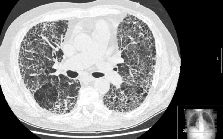 Tento soubor podléhá licenci Creative Commons. Foto: Drriad