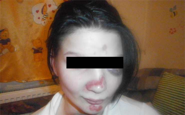Muž z Litoměřicka doma týral svoji družku, napadal ji slovně i fyzicky. Hrozí mu až osmiletý trest
