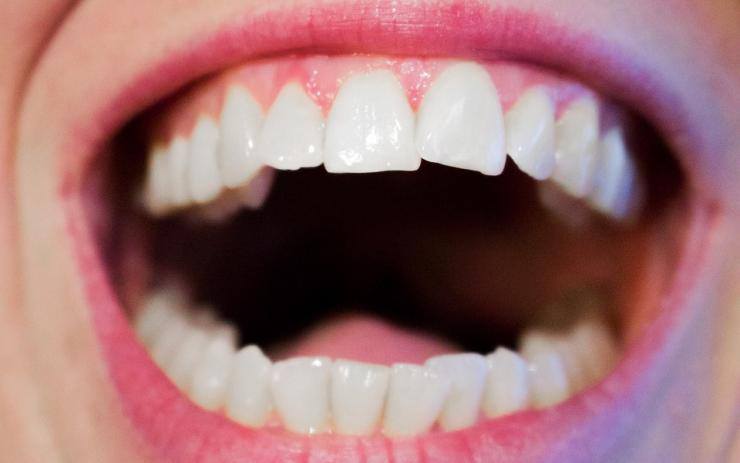 Návštěvy u zubaře se bojí skoro pětina lidí. Navštívit byste ho měli dvakrát do roka