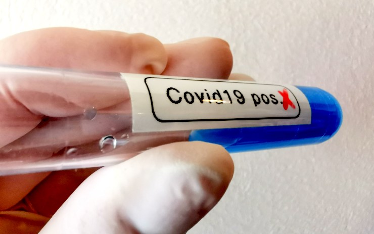 Koronavirus přežije v těle deset dní. I lidé s pozitivním testem nemusejí být infekční, karanténa se bude ukončovat jinak