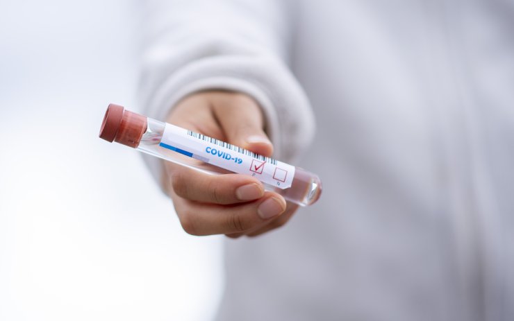 Opět mírný nárůst! V kraji má dalších sedm lidí pozitivní test na koronavirus