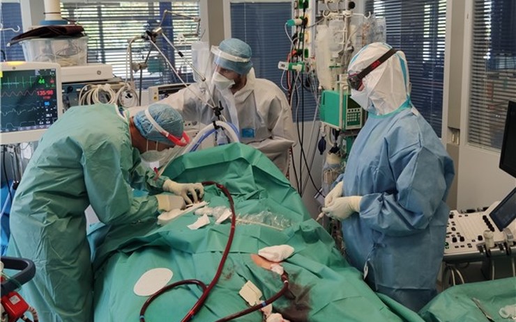 OBRAZEM: Pacienta s covid-19 zachránili v nemocnici Krajské zdravotní pomocí mimotělního oběhu