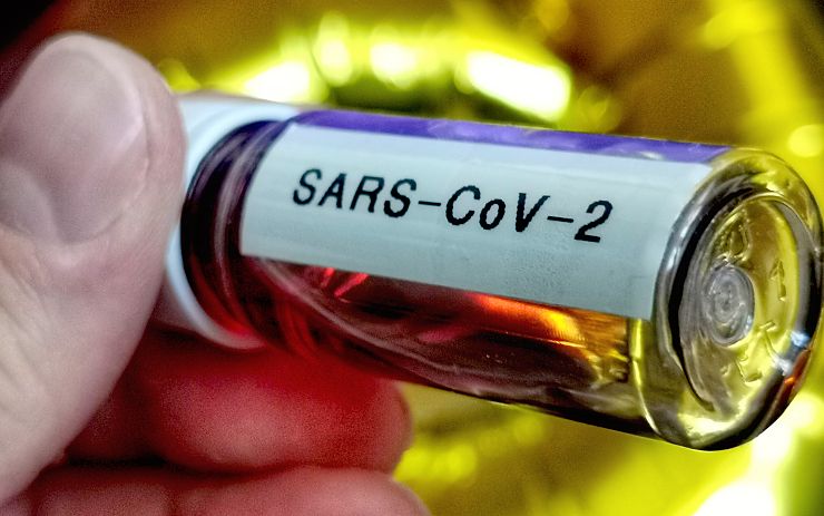 Na Teplicku jsou první dva potvrzené případy nákazy koronavirem. Tři lidé v Česku zemřeli