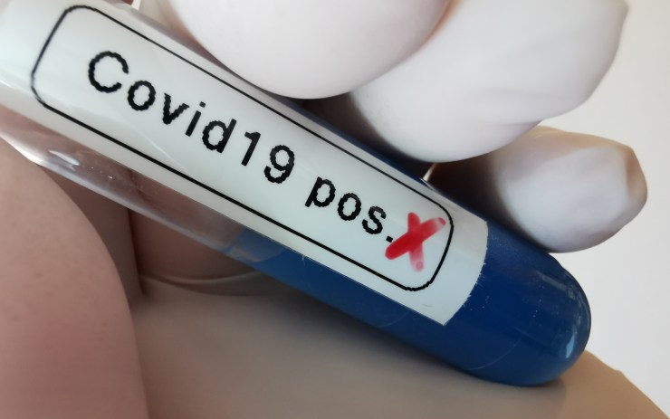 Testy potvrdily koronavirus u dalších 22 lidi v kraji. A vyléčila se 96letá žena!