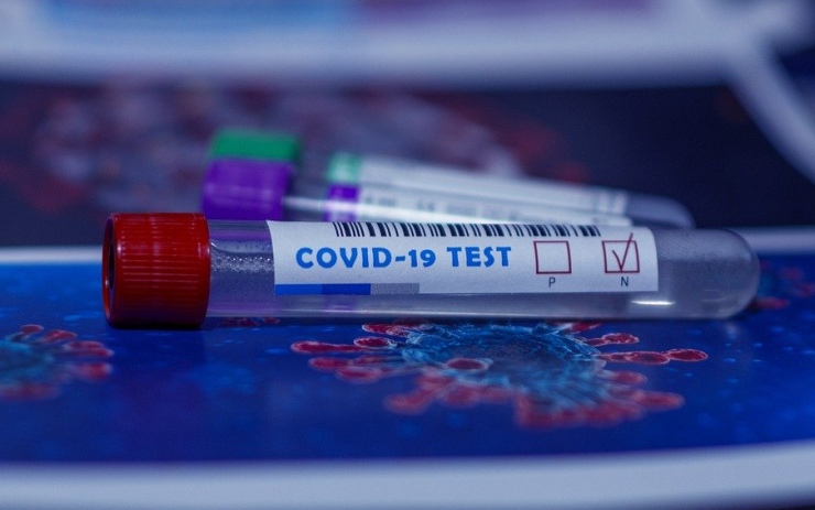 Na Ústecku přibylo 139 nových případů koronaviru. Jak jsou na tom jednotlivé okresy?