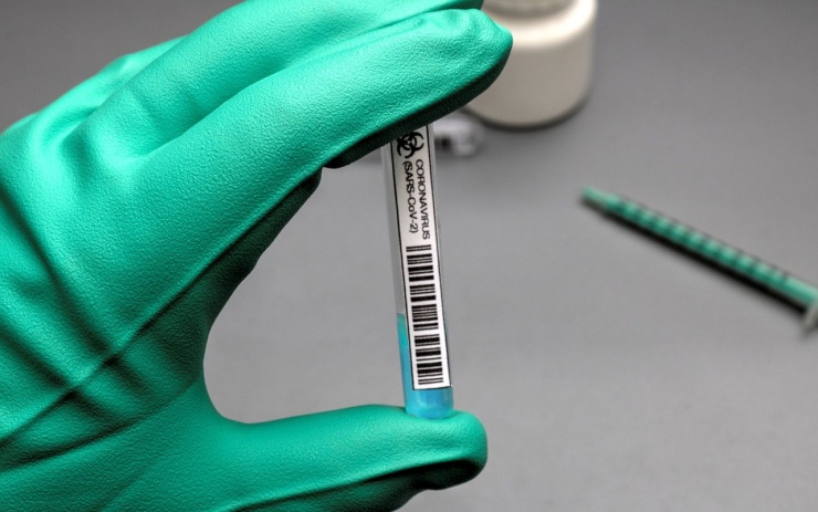 Na Litoměřicku přibylo 176 nových případů koronaviru. Počet pozitivních testů v kraji se vyšplhal na 25 tisíc