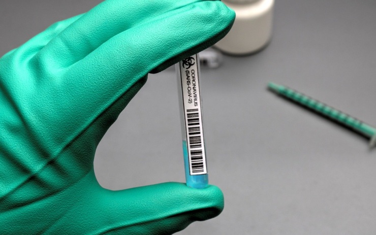 V Česku bylo potvrzeno přes padesát případů opakované nákazy koronavirem