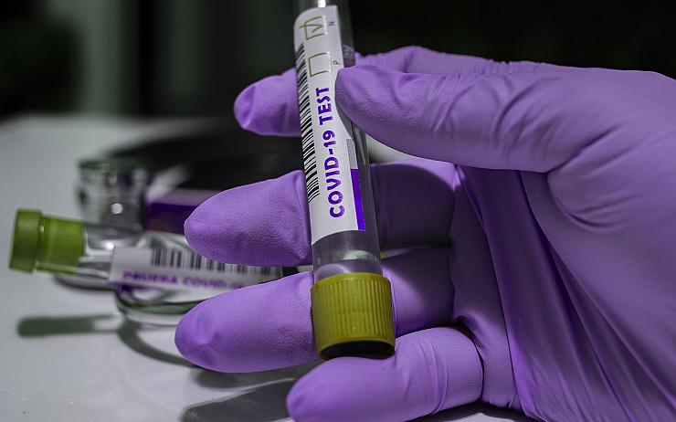 Nové testovací místo na Covid-19 je i v Jílovém. Dva dny v týdnu bude u bývalého kina sanitka ČČK